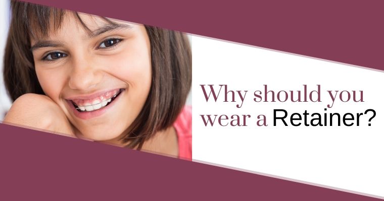 How Long Should You Wear a Retainer?