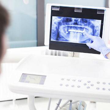 Using advanced dental technology, a patient x-ray is being examined on a digital display.